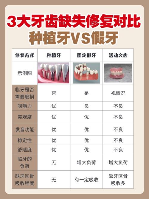 口腔最常见修复方法有哪些?适用情况如何?-图1 口腔最常见修复方法有哪些?适用情况如何?-图1
