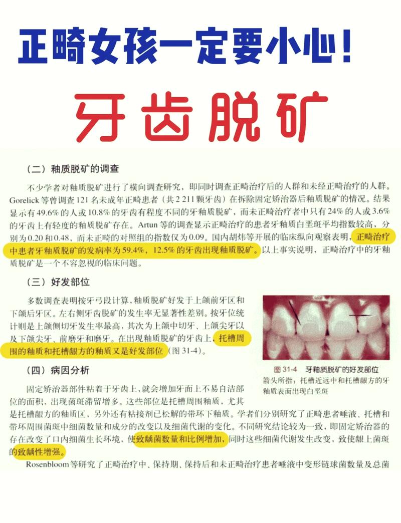 牙齿矿化的治疗方法有哪些？如何有效选择？-图3