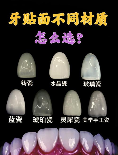 贴面的正确使用方法-图3 贴面的正确使用方法-图3