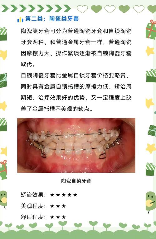 正畸用带环的原因究竟是什么？-图2