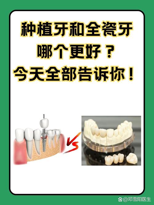 做过瓷牙后还能种牙吗?有影响吗?-图1 做过瓷牙后还能种牙吗?有影响吗?-图1