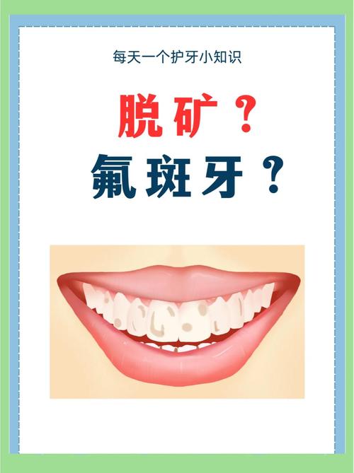 氟斑牙因何形成?有哪些科学有效的治疗方法?-图2 氟斑牙因何形成?有哪些科学有效的治疗方法?-图2