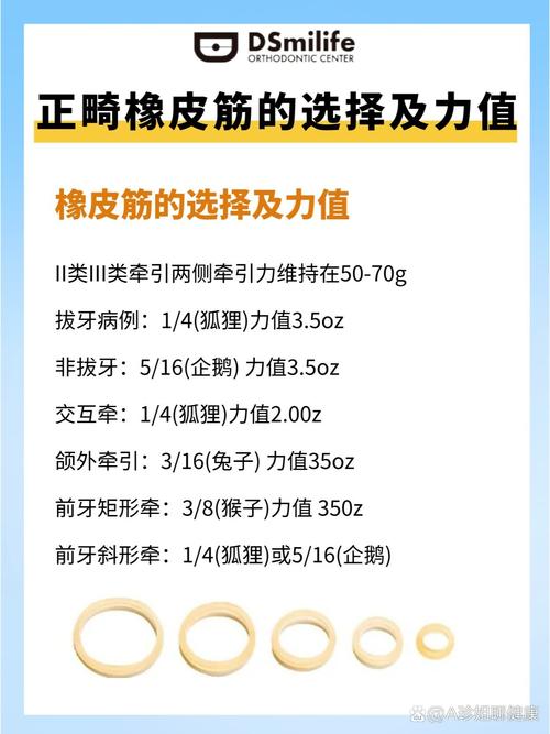 正畸三类牵引皮筋型号有哪些？各自适用于哪些牙齿矫正情况？-图2