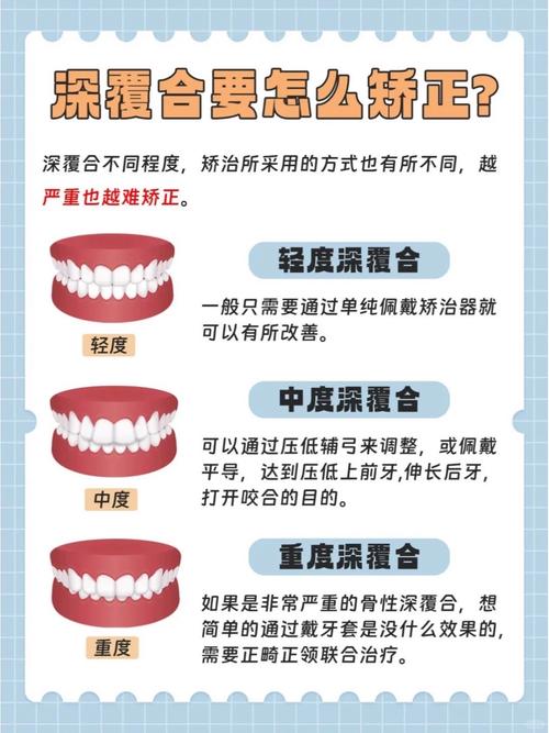 正畸深覆合的原理是什么？矫正方法有哪些？-图3
