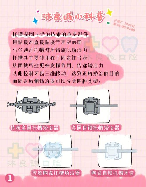 金属托槽夹取如何做到精准高效？关键方法与操作技巧全解析-图1