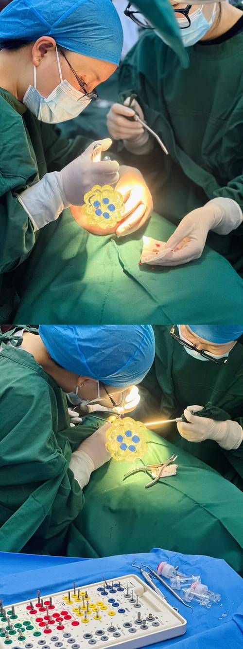 沧州中心医院种牙怎么样？效果和价格靠谱吗？-图1