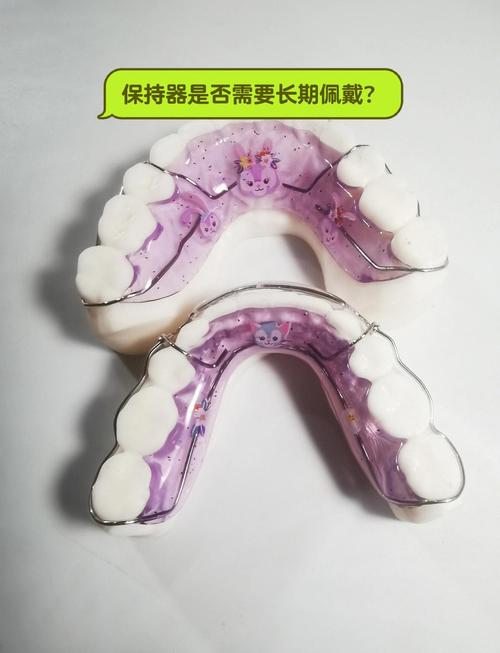 口腔正畸保持器方法有哪些？如何正确使用才能长久维持效果？-图3