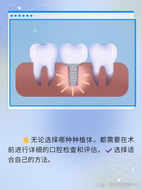 种牙材料哪国最好？进口与国产如何选？-图3