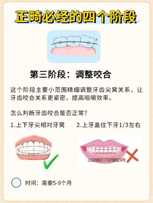 25岁正畸牙齿可行吗？年龄会影响矫正效果和周期吗？-图2