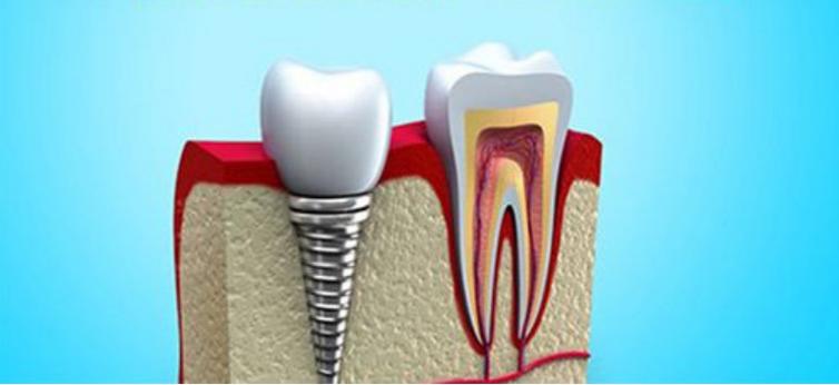 成都正畸费用多少？圣贝怎么收费？-图3