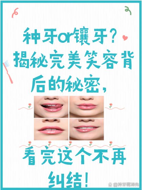 镶牙和种牙哪个安全-图3 镶牙和种牙哪个安全-图3