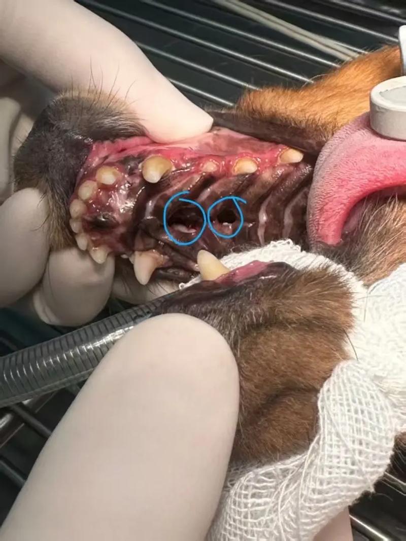 上颌骨缺损修复方法有哪些临床选择与应用策略？-图1