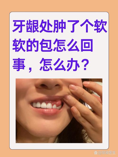 种牙后肿胀一般持续多少天？-图2