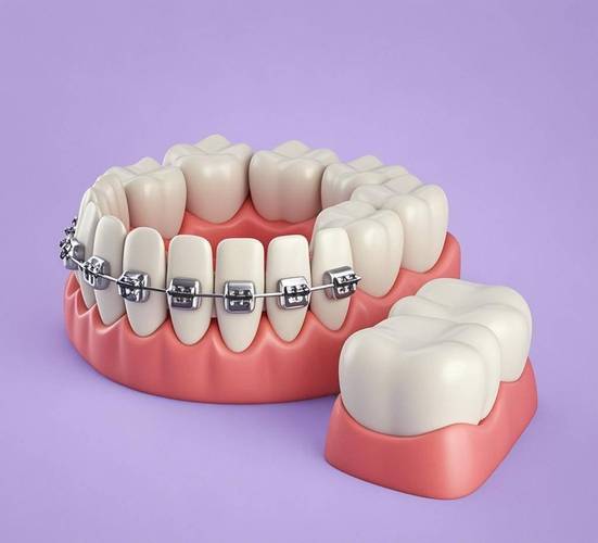 口腔正畸只针对儿童?成人矫正可行吗?-图1 口腔正畸只针对儿童?成人矫正可行吗?-图1