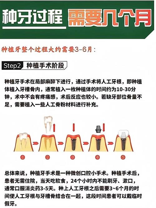 种牙后需要经常护理吗？日常维护该怎么做？-图3