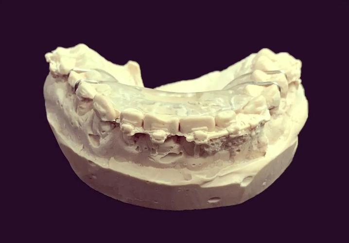 牙齿正畸导板太难受，到底该怎么办？-图1