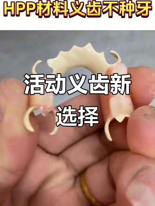 活动性义齿如何正确保存?-图1 活动性义齿如何正确保存?-图1