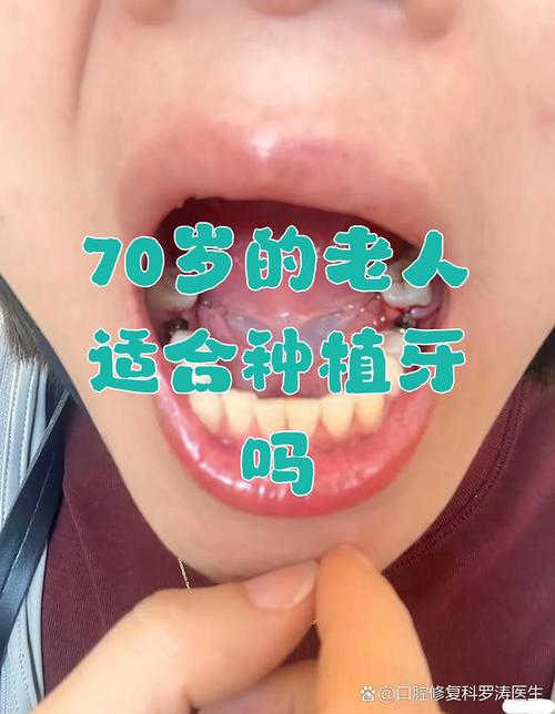 南京老人适合种牙吗？年龄是决定因素吗？-图2