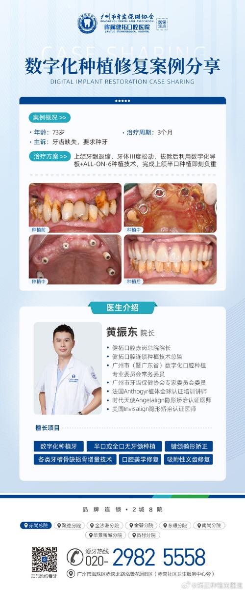 广州种牙技术那家好-图2