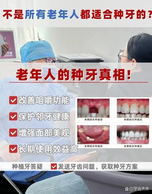 60多岁种牙有年龄限制吗？种植条件需注意哪些？-图2