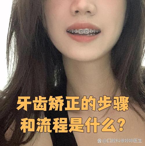 50岁牙齿矫正可行吗?有哪些适合的方法?-图1 50岁牙齿矫正可行吗?有哪些适合的方法?-图1