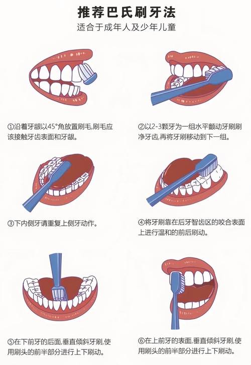 牙齿除烟渍的最佳方法究竟是什么？到底如何选择最有效的？-图3