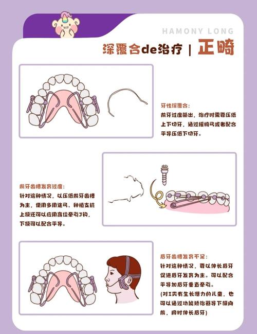 直面深覆盖矫正，哪种方法最直接有效？-图3