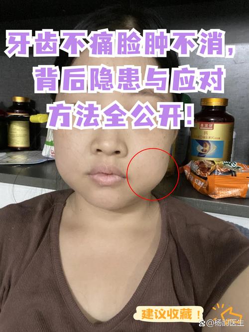 种牙后脸肿怎么快速消肿？实用方法有哪些？-图1