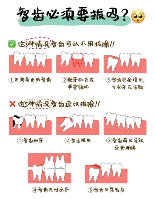 无疼拔牙方法真的存在吗?拔牙不疼有解吗?-图2 无疼拔牙方法真的存在吗?拔牙不疼有解吗?-图2