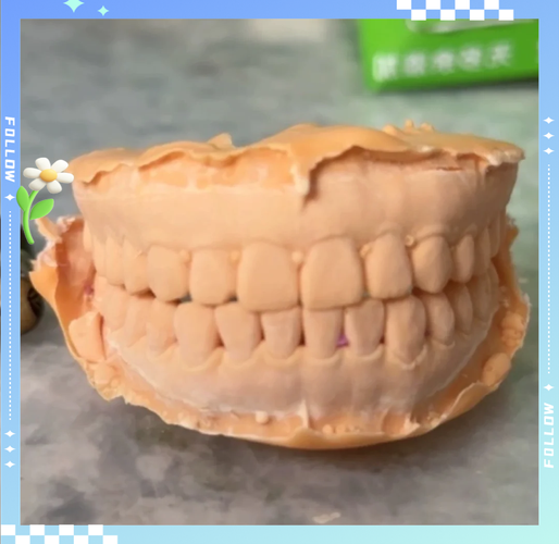 正畸硅橡胶取模方法如何规范操作？关键步骤与临床技巧全解析-图2