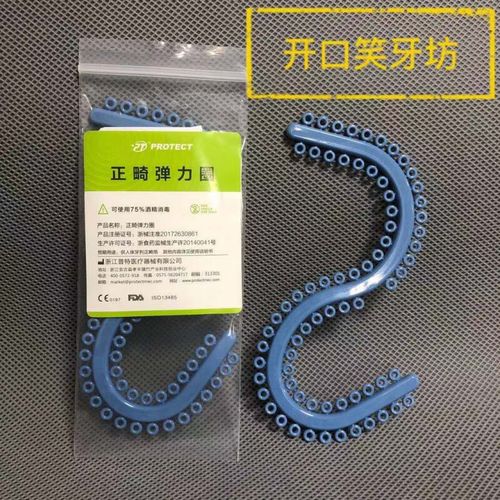 正畸分牙簧一般需要佩戴几天？-图2