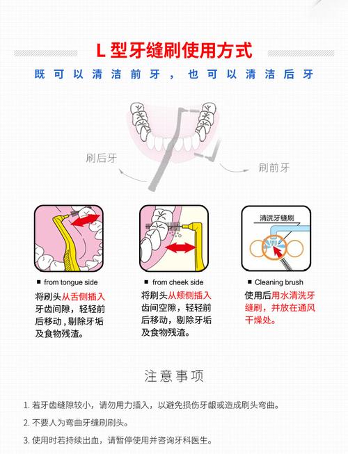 如何正确使用正畸牙间隙刷？详细步骤、技巧与注意事项全解析-图1