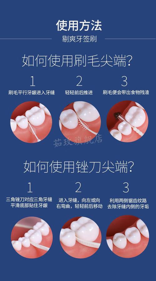如何正确使用正畸牙间隙刷?详细步骤、技巧与注意事项全解析-图3 如何正确使用正畸牙间隙刷?详细步骤、技巧与注意事项全解析-图3