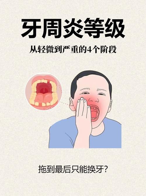 牙周炎患者种牙真的有必要吗?-图1 牙周炎患者种牙真的有必要吗?-图1