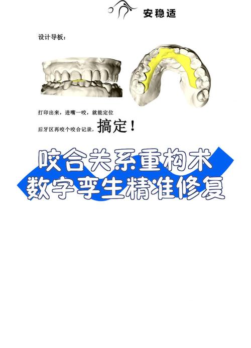 咬合关系转移的方法-图1 咬合关系转移的方法-图1