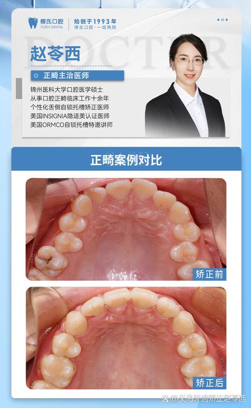 同步齿科做正畸效果如何？专业度与服务体验靠谱吗？-图2