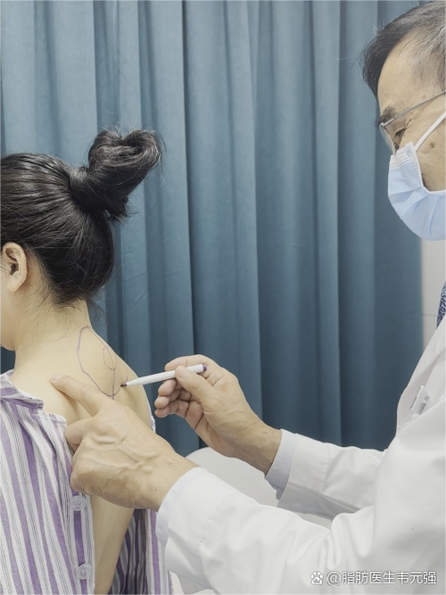 下颌骨囊肿冲洗如何规范操作?关键步骤与注意事项有哪些?-图1 下颌骨囊肿冲洗如何规范操作?关键步骤与注意事项有哪些?-图1