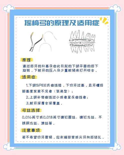 正畸摇椅弓弯制方法具体步骤是怎样的？技巧与要点解析-图1