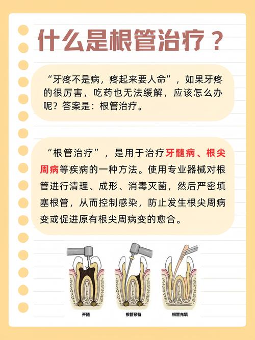 蛀牙补牙方法有哪些？哪种最适合不同蛀牙情况的治疗？-图2
