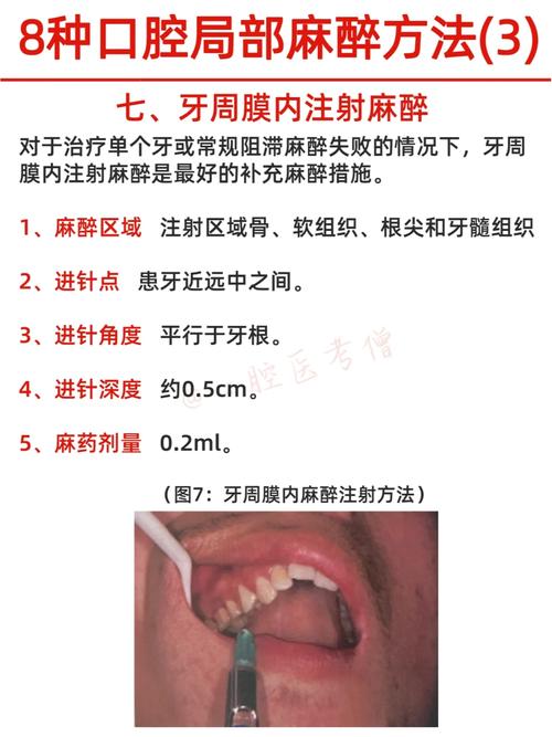 种牙手术为何采用局部麻醉?其具体类型和适用情况是怎样的?-图1 种牙手术为何采用局部麻醉?其具体类型和适用情况是怎样的?-图1