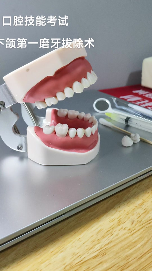 下颌磨牙的拔除方法-图2 下颌磨牙的拔除方法-图2