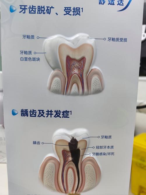 苏州牙博士洗牙方法与传统方法有何不同?-图3 苏州牙博士洗牙方法与传统方法有何不同?-图3