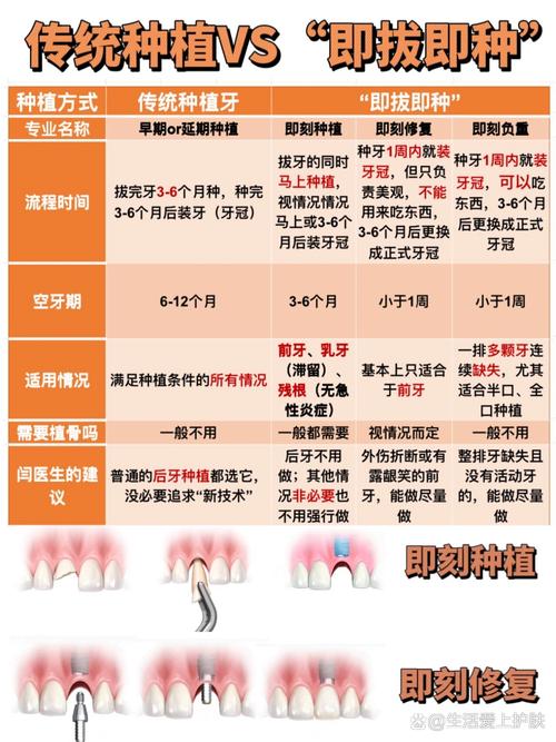 牙医为何热衷于种植牙？技术、需求与职业驱动因素分析-图2