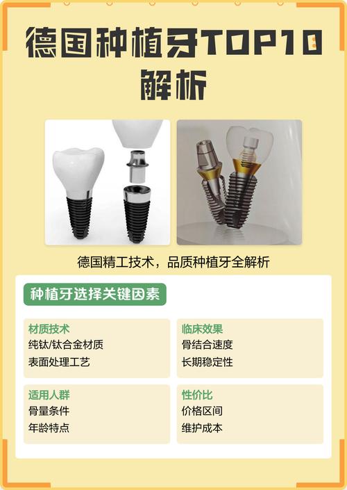 德国种牙品牌哪个好？如何选到靠谱又优质的？-图1