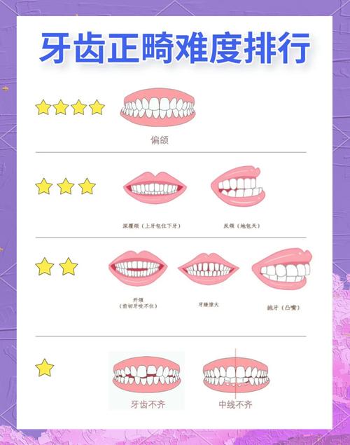 牙齿矫正常用方法有哪些?哪种更适合你的牙齿情况?-图1 牙齿矫正常用方法有哪些?哪种更适合你的牙齿情况?-图1