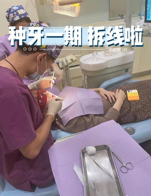 种牙术后拆线前能运动吗?这些注意事项要知晓-图1 种牙术后拆线前能运动吗?这些注意事项要知晓-图1