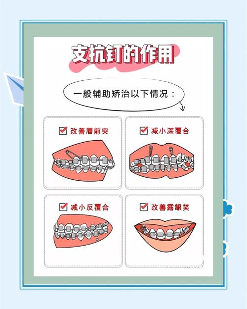 正畸支抗钉植入方法的关键步骤与操作要点是什么？-图3