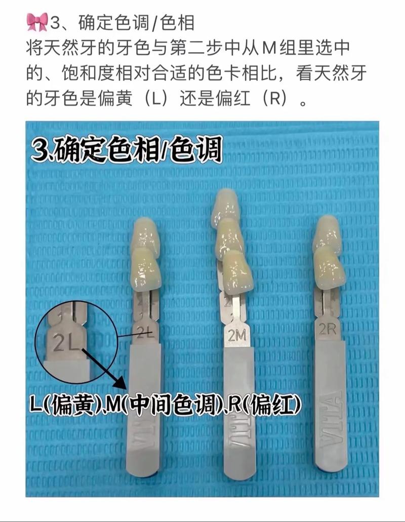口腔比色仪的分类方法具体包含哪些分类标准和类型？-图1
