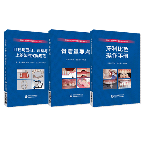 口腔比色仪的分类方法具体包含哪些分类标准和类型？-图2