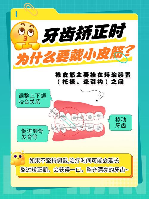 正畸为何要挂皮筋？作用原来这么关键！-图2